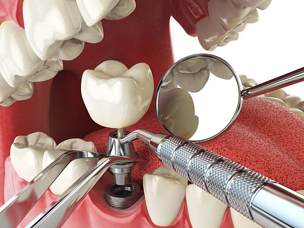 Best Same-Day Emergency Dentist in Collegedale, TN